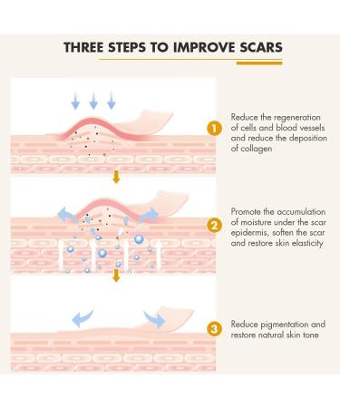 Silicone Scar Sheets 8 PCS Reusable Silicone Sheets for Scar Removal Professional Gel Scar Repair Treatment for Skin Trauma Surgery Burn Acne C-Section Scars White - Buy Online on GoSupps.com