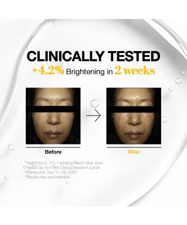 it:fu 10% Niacinamide Glow Toner | K-Beauty Hydrating Toner with Mango Vitamin C & Rice Extract | Skin Tone Correcting Brightening & Youthful Glow (10.14 fl. oz) - Buy Online on GoSupps.com