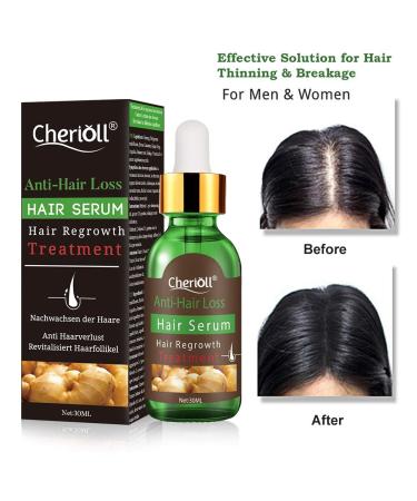 Hair Growth Serum - Stimulate New Growth, Thicker & Fuller Hair - Hair Loss & Thinning Treatment - Buy Online on GoSupps.com