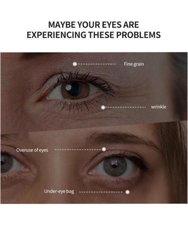 PCC PTYXIS Eye Cream Eye Firming Treatment Anti Wrinkle Eye Cream Dark Circles Eye Cream Fade Wrinkles Fights Dark Circles and Dark Circles 1 30g 1 30 g 1er Pack - Buy Online on GoSupps.com