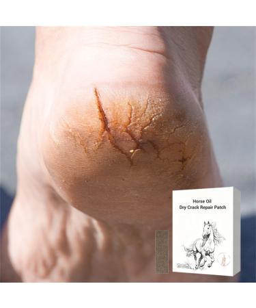 Horse Oil Dry Crack Repair Patch foot cream for dry cracked heels and feet Horse Oil foot balm repairing cream for knees elbows and hands Hands - Buy Online on GoSupps.com