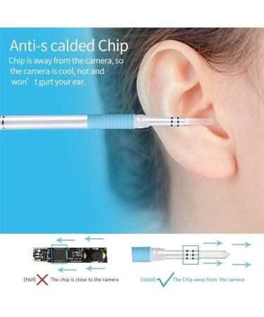 Marycan 5.5mm HD Ear Wax Removal Kit - Wireless Smart Phone Otoscope with WiFi Camera - 6 LED Lights - for Adults, Kids, Pets - Co Pink - Buy Online on GoSupps.com