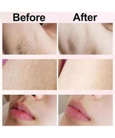 Lunaobrik Electric Hair Remover for Women Double Shaver and Facial Trimmer with Precision Portable Hair Removal Machine Electric Shaver for Arms Legs and Armpits Blue - Buy Online on GoSupps.com