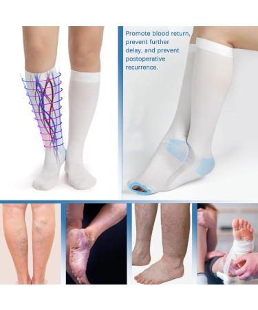 Open Toe Thrombosis Socks - Medical Compression Stockings for Varicose Veins | Class 1 Compression Knee Socks (White M) - 1 Pair - Buy Online on GoSupps.com