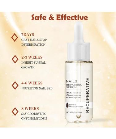 Nail Growth and Strengthening Serum 20ml Nails Repair Serum Fungal Nail Treatment for Toenail Extra Strong Toenail Growth Treatment for Repairing Damaged and Discolored Nails Improve Onychomycosis - Buy Online on GoSupps.com