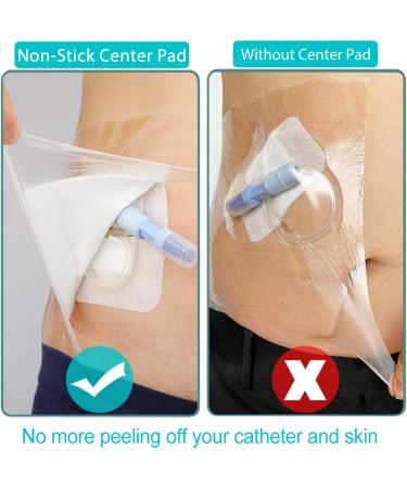 Waterproof Shower Protector for PICC Line, Dialysis Catheter & Feeding Tube - Pack of 25, 9x9 with Non-Stick Center Pad - Buy Online on GoSupps.com