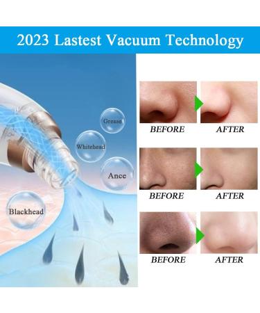 2023 Blackhead Remover Vacuum Kit - 6 Probes, Facial Cleaner for Face & Nose - Acne Extractor Tools - Buy Online on GoSupps.com