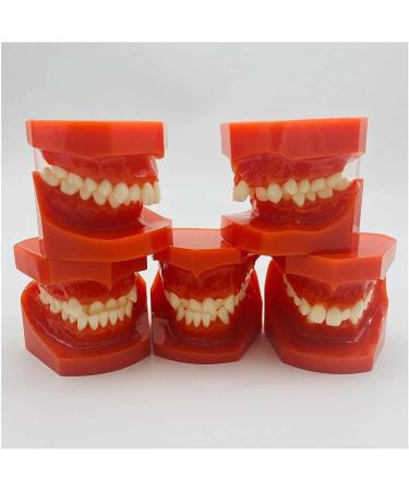 Teeth Educational Model - Orthodontic Classification & Lesson Model for Dental Training | International Shipping Available - Buy Online on GoSupps.com