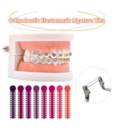 1040 Pcs Multicolored Orthodontic Ligature Ties O-Rings for Braces - Elastic Bands (Color) - Buy Online on GoSupps.com