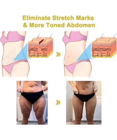 2PCS Firming and Regenerating Creams 2024 New Advanced Skin Firming Cream Restore Skin Elasticity Moisturizing Lotion for Face and Body - Buy Online on GoSupps.com