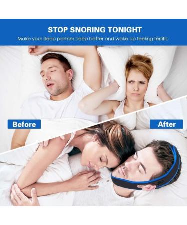 Yomitek Adjustable Anti Snoring Chin Strap Anti Snoring Device Stop Snoring Jaw Strap Comfortably for Men and Women Give You The Best Sleep of Your Life and Snoring Solution Blue - Buy Online on GoSupps.com