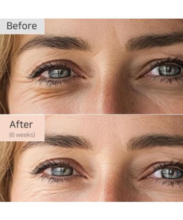 Beauty Ginseng + Revive Eye S rum 30 ml Skincare Cor en Kbeauty Koreanskincare Retinal -Skinkura - Buy Online on GoSupps.com