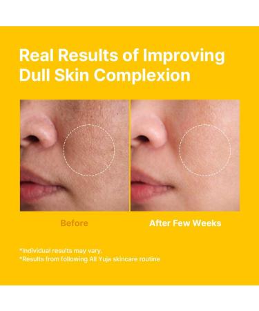 Farmstay Citrus Yuja Vitalizing Toner Vitamin C Facial Toner for Dry & Sensitive Skin Dark Spot Correcting Moisturizing & pH-Balancing Smoothing Korean Skin Care for Women & Men 9.46 fl. oz. - Buy Online on GoSupps.com