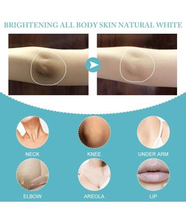 Fengyang Acanthosis Nigricans Cream Anti-Dark Spots Cream Correcting Cream for Elbow Knee Joint - Buy Online on GoSupps.com