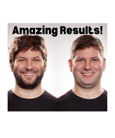 Magic Razorless Shave Kit - Extra Strength 4.5 oz | Renewed Provisions | International Shipping Available - Buy Online on GoSupps.com