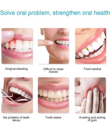 Cordless Water Flosser - Portable, Rechargeable, IPX7 Waterproof - 3 Modes, 5 Jets - Dental Oral Irrigator for Travel & Home - White - Buy Online on GoSupps.com