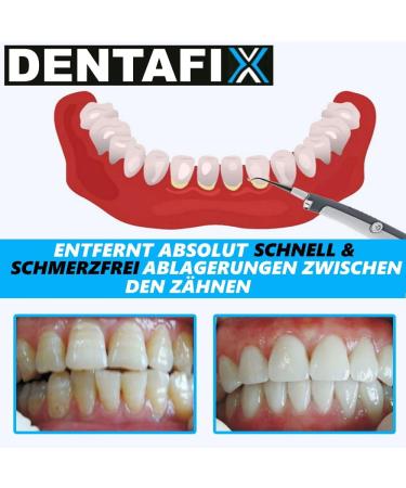 Dentafix Electric Tartar Remover - Ultra Sonic Tooth Cleaner & Plaque Removal Tool | Dental Care for Healthy Teeth - Buy Online on GoSupps.com