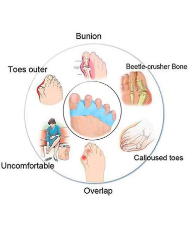 Clicitina Foot Toe Pair Hammer Smoothing Corrector - Silicone Separator for Comfort | Sport QB343 (Blue One Size) - Buy Online on GoSupps.com