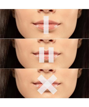 Mouth Strips Sleep Tapes | Gentle Snore Reducing Strips | Medical Grade Microporous | Breathable Nighttime Tape | Easy Tear | 1 Roll 354inches - Buy Online on GoSupps.com
