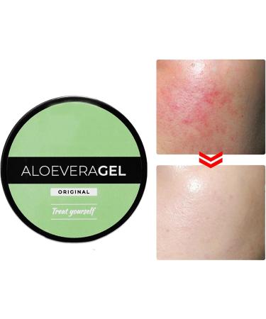 Botiniv Organic Aloe Vera Gel Natural Moisturizing Cream | Face and Body Moisturizer Aloe Vera Cream for Dry Skin Sunburn Soothing and Hydrating Easy to Absorb - Buy Online on GoSupps.com