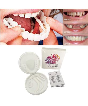 Instant Snap Veneers: Teeth Socket Perfect Braces & Whitening Alternative - No Pain, No Shots, No Drilling (1 Upper + 1 Lower + 2 Adhesives) - Buy Online on GoSupps.com