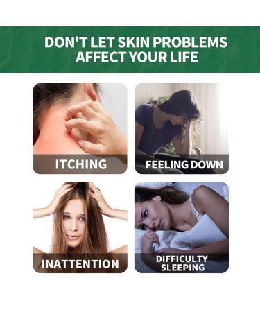 Chinese Herbal Psoriasis Cream for Skin Problems | Natural Skin Psoriasis Treatment - Buy Online on GoSupps.com