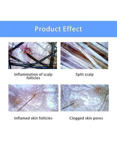 Skin Diagnosis Hair Analyzer - 10.1" Follicle Detector with 4 Spectrum Detection & Image Freeze Zoom Function for Accurate Scalp Analysis - Buy Online on GoSupps.com