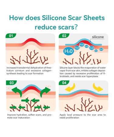 Dimora Waterproof Silicone Scar Sheets - Medical Grade Scar Tape for Surgical Scars C-Section & Keloids | Ultra-Thin Scar Removal Treatment (1.6 x120 Roll - Buy Online on GoSupps.com