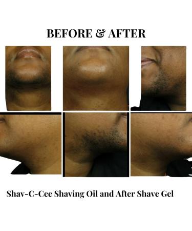 Shav-E-Cee After Shave Gel | Soothing & Hydrating | International Shipping Available - Buy Online on GoSupps.com