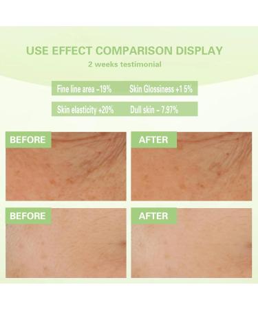 Face Serum for Women Fruit Facial Serum with 24K Gold Foil and Apple Cell Culture Extract Anti Aging Moisturizer Skin Tone Even Anti Wrinkle Essence for Reduces Dulls & Fine Lines 1.02Fl Oz - Buy Online on GoSupps.com