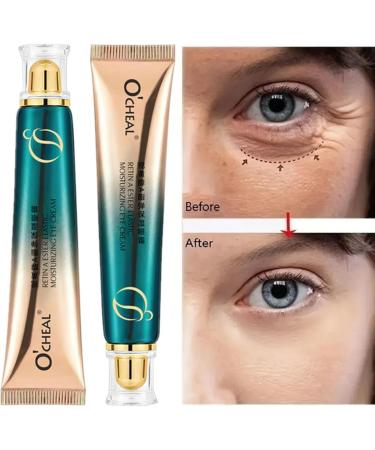 KARLOR Eye Cream Anti-Dark Circles Retinol Eye Cream Oxygen Cream for the Eye Area Anti-Wrinkle Eye Cream for Dark Circles Wrinkles Fine Lines Retinol Eye Cream Anti-Ageing - Buy Online on GoSupps.com