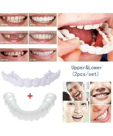 Zmoope Instant Veneers - 10 Pair Temporary Smile Cosmetics | Comfort Fit Dentures & Teeth Stickers for Perfect Smile - Buy Online on GoSupps.com