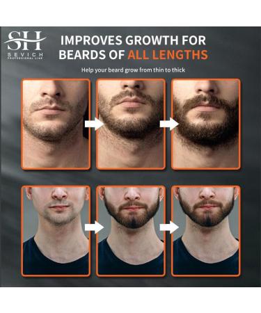 SEVICH Chebe Beard Growth Oil - Natural African Essence for Moisture & Strengthen Beard | 30ml Regrowth & Skin Refresh - Buy Online on GoSupps.com