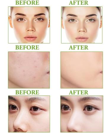 Fengyang Air Cushion CC Cream BB Cream CC Cream Cushion Foundation Clio Cushion Foundation Cushion Foundation Korean Air Cushion BB CC Foundation Long Lasting Foundation(Natural) - Buy Online on GoSupps.com