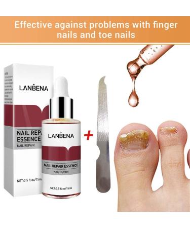 Maximum Strength Nail Fungus Repair Treatment - Natural Formula for Toenail and Fingernail Repair - Buy Online on GoSupps.com