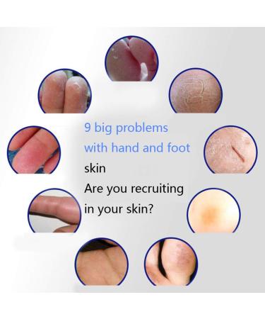 MRB Foot Care Cream - Repair Very Dry Feet & Cracked Heels | 55g Moisturizing Solution for Healthy Feet - Buy Online on GoSupps.com