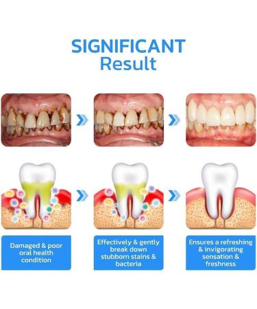 Gum Instant Treatment Gel 2024 New Gum Shield Therapy Gel Gum Therapy Gel Gum Shield Therapy Gel Teeth Whitening Essence Pen Rejuvenate Your Gums - Buy Online on GoSupps.com