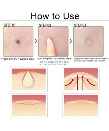 Rpanle Acne Patches 180 Pcs - Hydrocolloid Dots for Spots - Calms & Relieves Acne - Facial Care (12mm & 8mm) - Buy Online on GoSupps.com