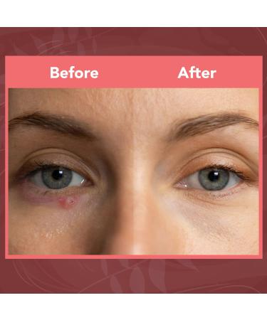 NOVEHA Extra Nove Eyelid Foaming Cleanser | Daily Eyelash & Lid Care Eye Irritations Stye Relief | Organic Ingredients | 3.38 oz - All Skin Types - Buy Online on GoSupps.com
