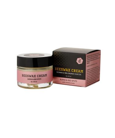 Olivia…Natural Beauty! Beeswax cream for burns and redness