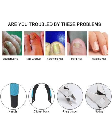 Syrisora Ingrown Toe Nail Clippers Fingernail Toenail Cuticle Scissors Pedicure Cutter Tool - Buy Online on GoSupps.com