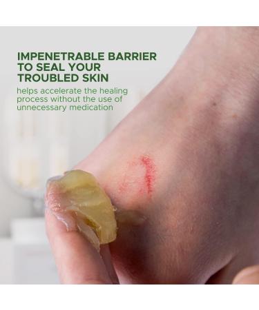 Med Pride Petroleum Jelly with Aloe Vera & Vitamin E - 13oz Skin Protectant for Dry Skin Rashes Burns & Chapped Lips - Powerful Moisturizer for Diaper Rash & Chaffed Skin - Buy Online on GoSupps.com