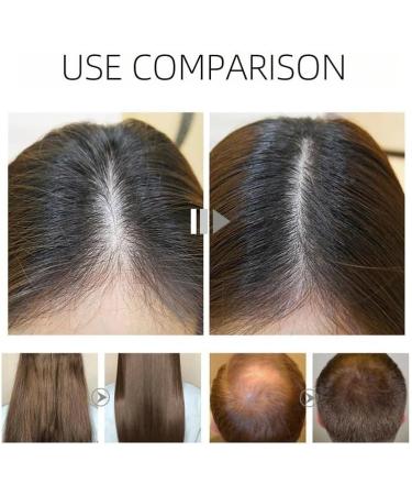 S rum pour la croissance capillaire soin du cuir chevelu nourrissant et fortifiant favorise la repousse et r duit la chute des cheveux hommes et femmes. - Buy Online on GoSupps.com