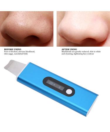 Skin Scrubber Face Spatula - Blackhead Remover & Pore Cleaner for Deep Facial Cleansing | Shop Internationally - Buy Online on GoSupps.com