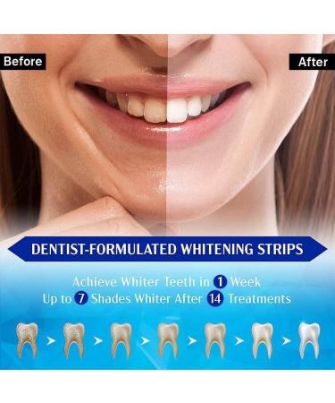 7-Piece Teeth Whitening Kit & Cleaning Tools - Remove Smoking & Coffee Stains, Dental Plaque - Mint Flavor 5D - Buy Online on GoSupps.com