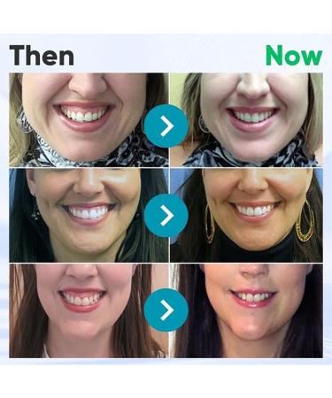 Buy Taileden Gel & Gum Therapy Gel for Recessed Gums - International Shipping | Teeth Whitening Essence Pen (3PCs) - Buy Online on GoSupps.com