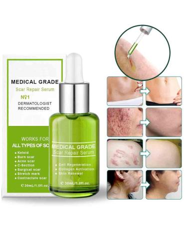 Goopgen Advanced Scar Repair Serum - Medical Grade Treatment for All Types of Scars (3PC) - Buy Online on GoSupps.com