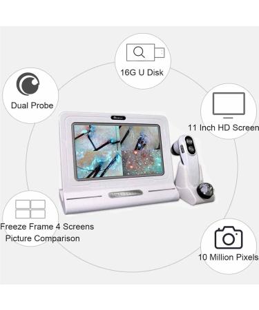 Hair Analyzer for Skin Diagnosis Hair Follicle Analyzer: 11 Inch High Resolution Scalp Detector with 10MP Camera 50x+200x Magnification for Oil Testing - Buy Online on GoSupps.com