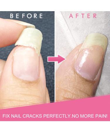 LOVEPLZ 5ML Cracked Broken Nails Repair Gel | Nail Extensions Treatment & Fashion Accessories - Buy Online on GoSupps.com