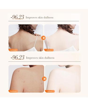 Turmeric Exfoliating Body Scrub - Exfoliator for Remove Dead Skin Deep Cleansing - Improve Dark Spots Acne Body Scrub - Hydrating & Exfoliating Exfoliator - Exfoliator for Body Care All Skin Types - Buy Online on GoSupps.com